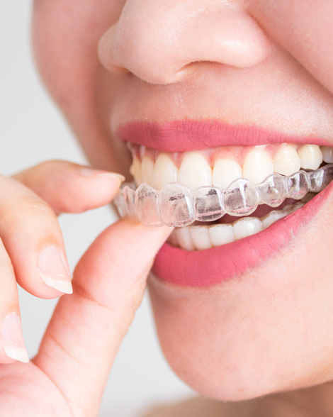 Ortodontia em Campos